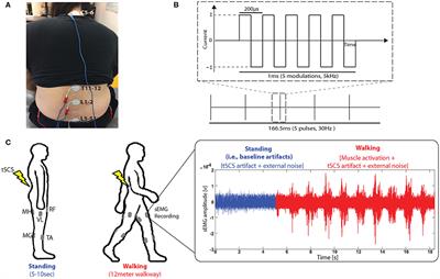 A Novel Technique to Reject Artifact Components for Surface EMG Signals Recorded During Walking With Transcutaneous Spinal Cord Stimulation: A Pilot Study